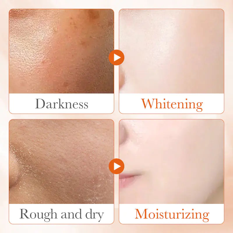SADOER Vitamin C Radiance Boosting Serum